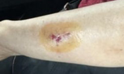 “무릎 스쳤잖아!” 버스서 4세 아동 때리고 할머니 팔 깨문 20대 여성