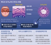 [IF] 췌장·편도선까지 미니 장기 구현… 생명 연장의 꿈 커져