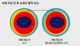“치매를 예방하려면 좀 불편하게 살아라”
