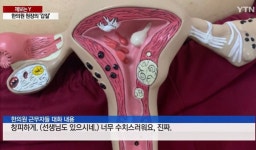 여직원 배에 자궁모형 올리고 ‘찰칵’…한의원 원장의 ‘갑질’