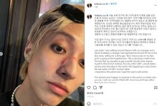 커밍아웃 가수 홀랜드, 한밤 중 이태원서 폭행 당해…“더러운 게이XX”