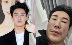일정 불참한 래퍼 산이, 퉁퉁 부은 얼굴…부비동염이 뭐기에