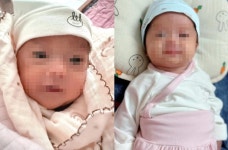 5주 간격으로 태어난 이란성 쌍둥이... 조산에도 건강히 성장