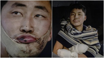 우크라 정보당국 “북한군 포로, 전쟁 끝나면 지체 없이 송환돼야”