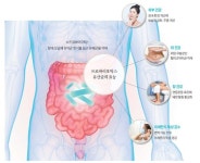 면역력·장건강에 좋다는 유산균, 부작용 정말 없을까