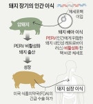 세계 놀래킨 돼지 심장 2개월만에 멈췄다…첫 이식 환자 사망