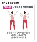 암환자 근육 단련은 달라야 한다…각별히 공들인 미니운동 [나영무 박사의 말기 암 극복기]