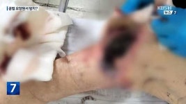 父 무릎 괴사해 진물...서귀포공립요양원 노인 학대 의혹