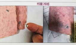 급식에 나온 유명 햄 자르자, 흰 덩어리가…돼지 지혈제였다