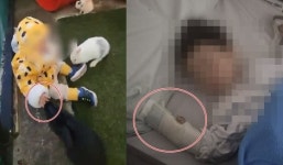 15개월 아이, 토끼에 물려 손가락 절단…제주 동물원서 무슨 일