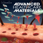 표피에 약물 전달 `마이크로 니들` 사업화 길 열어