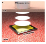 초음파·마찰전기 `체내 충전기술` 활용…배터리 교체없이 삽입형 의료기기 충전