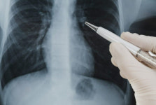 뷰노, AI기반 흉부엑스레이 판독기 혁신의료기기 승인