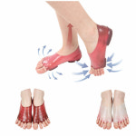 [굿!초이스 중소기업 우수제품]와이에이치라이프 발 스트레칭 전용슈즈 쿨핀