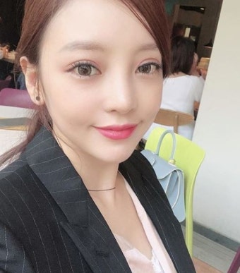 안검하수 수술 구하라 외에 또 누가 했나? ‘방치하면 큰일?’