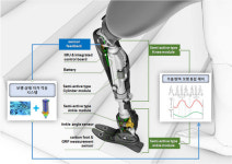 근로복지공단, 선진재활공학 기술로 직무복귀 앞당긴다…산재치료 확대