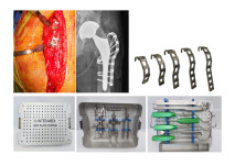 [2022광주메디헬스산업전 참여기관·기업]인터메디, 환자 맞춤형 임플란트 소개
