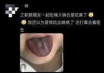 “훠궈 먹고 혀가 까맣게”…현지인도 경악한 中 식당 위생