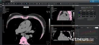 코어라인소프트, SCCT 2024서 AI 응급의료 솔루션 소개