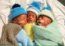 20억분의 1 기적...英서 일란성 세쌍둥이 태어나