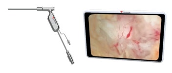 텍코드, 세계 최초 일회용 척추 내시경 eSpine Endoscope 출시