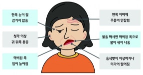 [주말엔 건강] 여름에 증가하는 안면신경마비…면역력 키워야