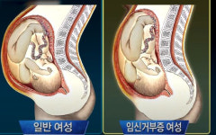 서래마을서 영아 사체 2구 발견…남편 몰래 아내 혼자 한 짓? [그해의 날들]