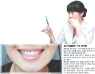 [건강]자연치아와 똑같잖아! ‘審美 임플란트’ 웃는다