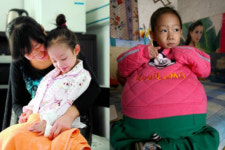 中 ‘배불뚝이 소녀’ 네티즌 도움으로 제 모습 찾아