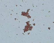 반려견 잡는 ‘자가면역성 용혈성빈혈’