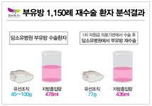 담소유병원 부유방 수술팀, 부유방 재수술환자 원인에 대한 임상연구 발표