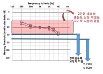 “난청아동 학교생활 위해 정부지원 강화해야”