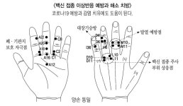 고려수지침학회 백신 접종 후 부작용 완화-개선에 손 부위 자극 효과 있다