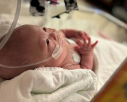 가장 ‘작은 아기’가 쓴 가장 ‘큰 기적’…지난 4월 ‘국내 최소’ 260g으로 태어난 ‘예랑이’