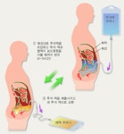 10년 동안 2배 늘어난 만성콩팥병 환자··· 이대로 둬도 될까요[의료 돋보기]