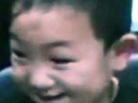 중국 안구적출 소년 의안 이식...시력 못 찾아