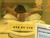 진단 방사선 피폭량, 연간 한도 넘어