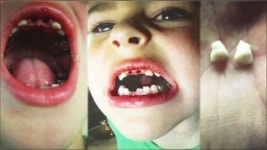 美 치과의사, 충격적 과잉진료 