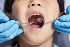 아아아… 썩은 열 살 ‘치아’가 여든 간다