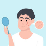 여드름 잘 나는 피부엔 약산성 세안용품이 적합