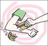 [곳모닝 1분 건강] 벌침부터 제거하세요