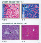 에나미네랄 | 몸의 반란, 나쁜 미네랄이 원인 ‘활성미네랄’로 힐링
