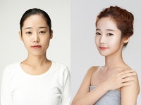 좋은 인상 만들려면? 모나지 않은 얼굴선이 기본
