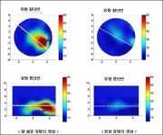 전자파로 유방암 진단... 방사선보다 안전