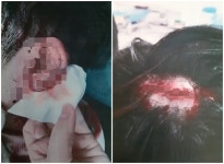 알바 퇴근길에 묻지마 각목 폭행 당한 예비 대학생 