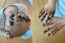 삼성 갤럭시 백혈병 노동자, 발병 1년만에 사과·복직 이뤘다