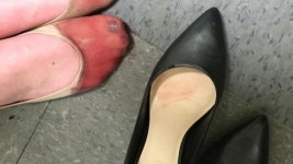 [SNS 세상] 이 사람의 발 사진이 분노를 일으키는 이유