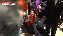 대구·경북 의사단체 권영진 후보, 골절 아닌 멍든 상태