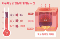 [라이프] 추운 날씨에 끼고 있다가 화상…뜨겁지도 않았는데?!