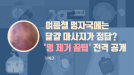 [라이프] 여름철 멍 자국에는 달걀 마사지가 정답?…멍 제거 꿀팁 전격 공개